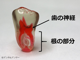 歯の構造解説写真（下の奥歯）