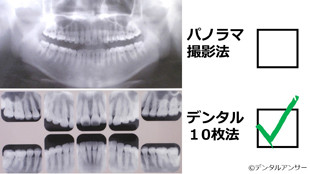 歯周病を専門的に治療する時のレントゲン